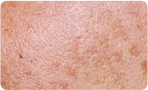 spotcare_img