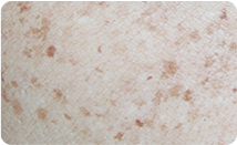 spotcare_img