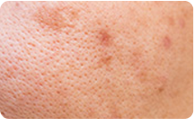 spotcare_img