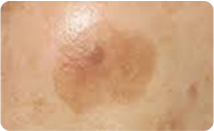 spotcare_img