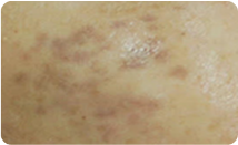 spotcare_img