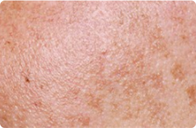 spotcare_img
