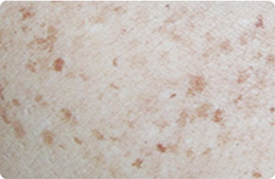 spotcare_img