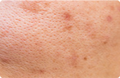 spotcare_img