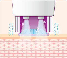 thermage_img