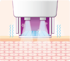 thermage_img
